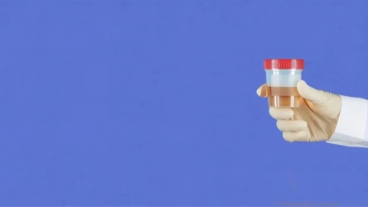 DOT & Non-DOT Urine Drug Testing - 5 Panel & 10 Panel Tests