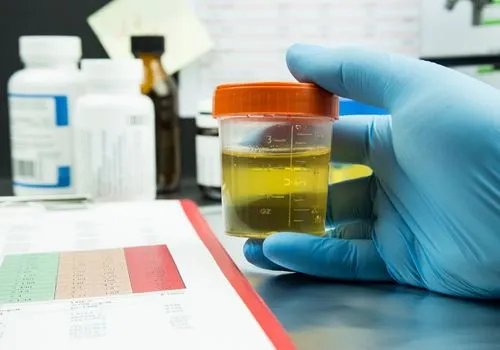 DOT Urine Test Facts You Need to Know