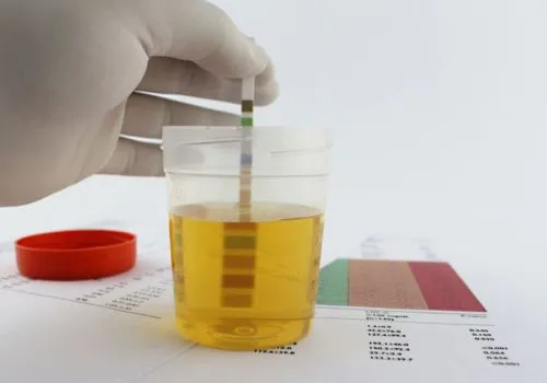 Can Synthetic Urine be detected in a Drug Test?