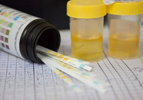 How long does it take to get drug test results?