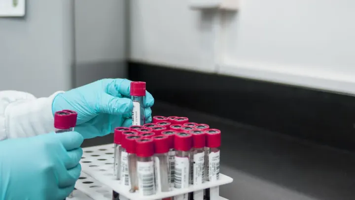 DOT Drug Testing Case Study of a negative test trucker