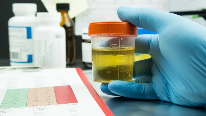 DOT Urine Test Facts for CDL Drivers and Employers