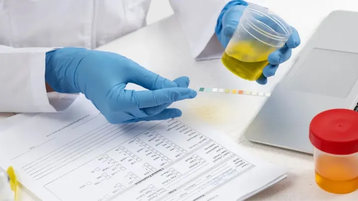 10-Panel Drug Test: Complete Guide to What It Detects, Detection Windows, and When Employers Use It