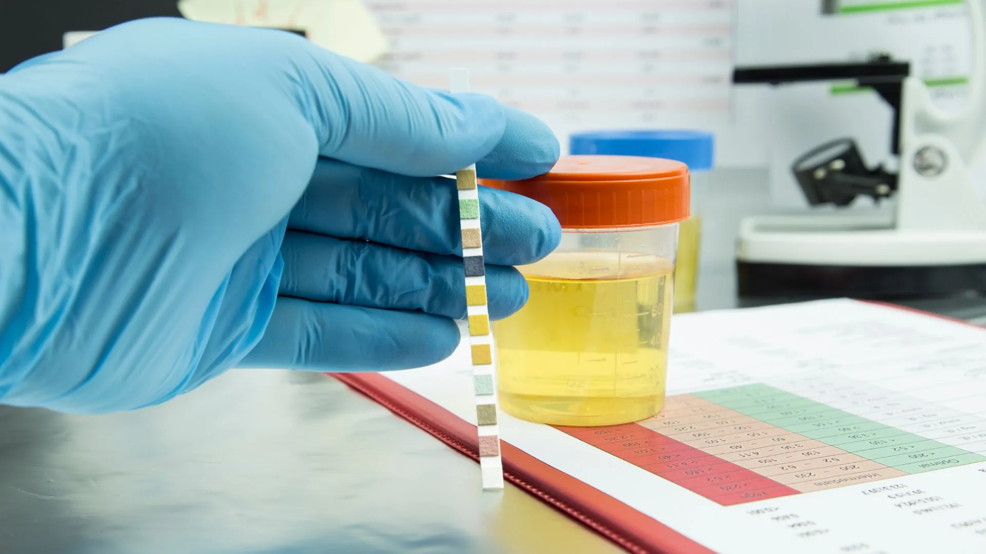 Most Innovative Things Happening with Urine Drug Test