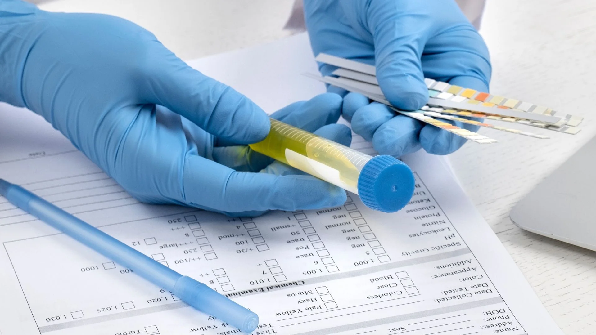 How to interpret drug test results?