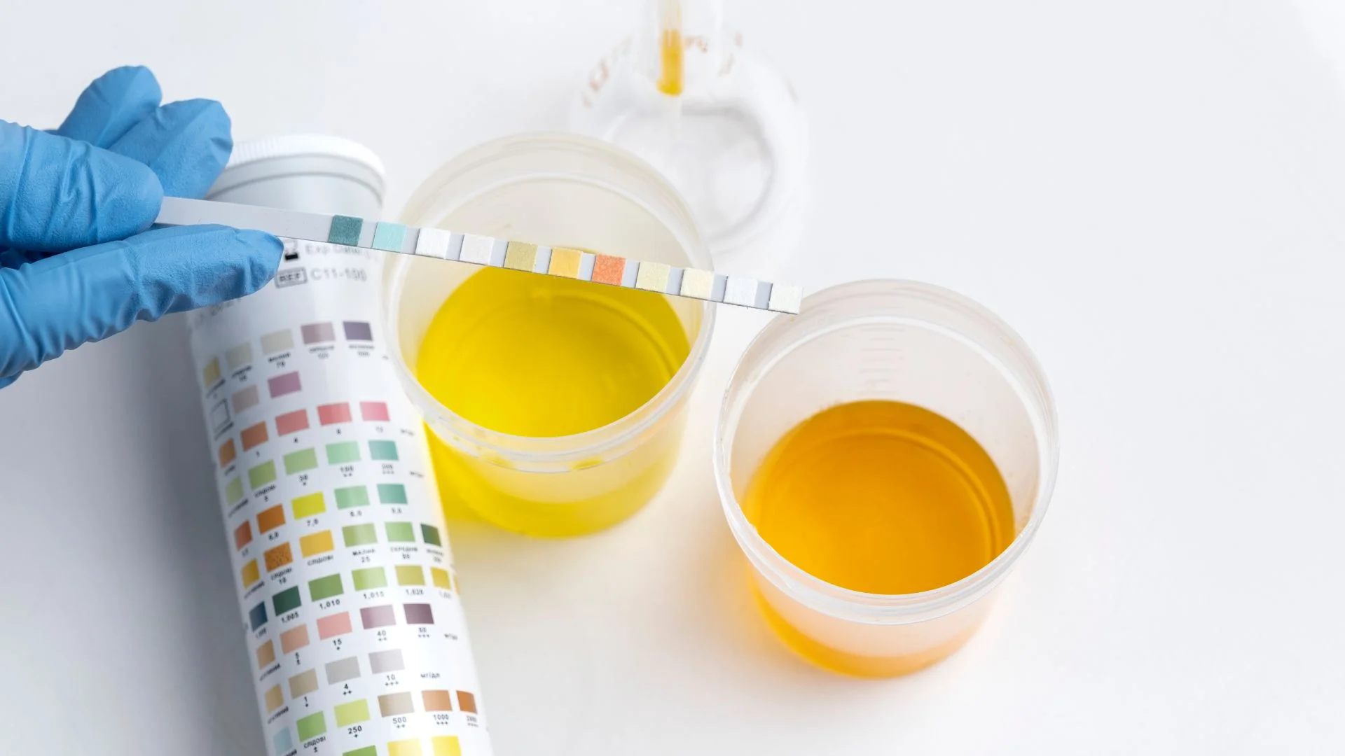 Can Synthetic Urine be detected in a Drug Test?