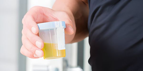 Five major substances are tested through urine drug test
