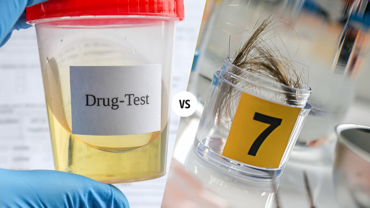 urine drug test vs hair drug test